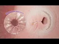 Download Lagu TORe Procedure Animation