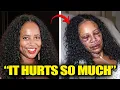 15 Black Celebrities Who Nearly Died From Plastic Surgery