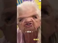 They dilated the eyes 👀 😂 #dilatedtheeyes #lol #funny #repost #grandma #oldlady #sofunny #reshare