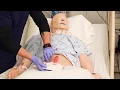 Wound Assessment for Nursing skills documentation example