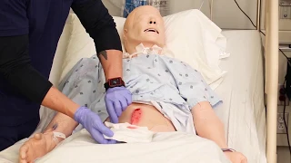 Wound Assessment for Nursing skills documentation example