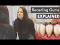 Why Are My Gums Receding 7 Ways to STOP Gum Recession