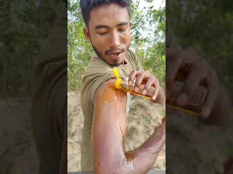 চিকিৎসার নামে এমন অদ্ভুত জিনিসও ছিল! #shorts #mrhelal