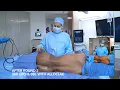 ALLOCLAE 360 Liposuction BBL Gender-Affirming Surgery Round 2 Transformation
