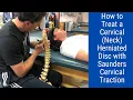 How to Treat a Cervical Neck Herniated Cervical Traction