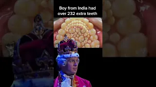 232 extra teeth Oral surgeon s dream