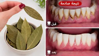 تخلصي من التبول اللاإرادي نهائيا بسر بسيط بالشبة النتيجة كتبان بسرعة وبدون أدوي
