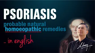 Psoriasis || Natural Homeopathic remedies with Symptoms || Dr Umang Khanna