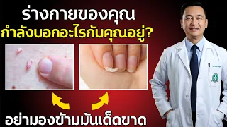 เล็บเปราะ แตกง่าย หรือแยกเป็นชั้น บ่งบอกถึงการขาดสารอาหารใด