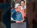 Derm Reacts Terrible Beard Waxing