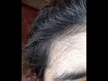 Download Lagu Cewek banyak bulu