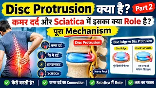 Disc Protrusion क्या है? | कमर दर्द और Sciatica में इसका क्या Role है? | पूरा Mechanism | Part 2