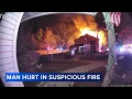 Man critically injured in Galloway Township condo fire investigators search for cause