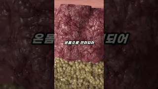 불법 의료행위로 발견된 70년 동안 분열을 멈추지 않는 불멸의 세포 Shorts 