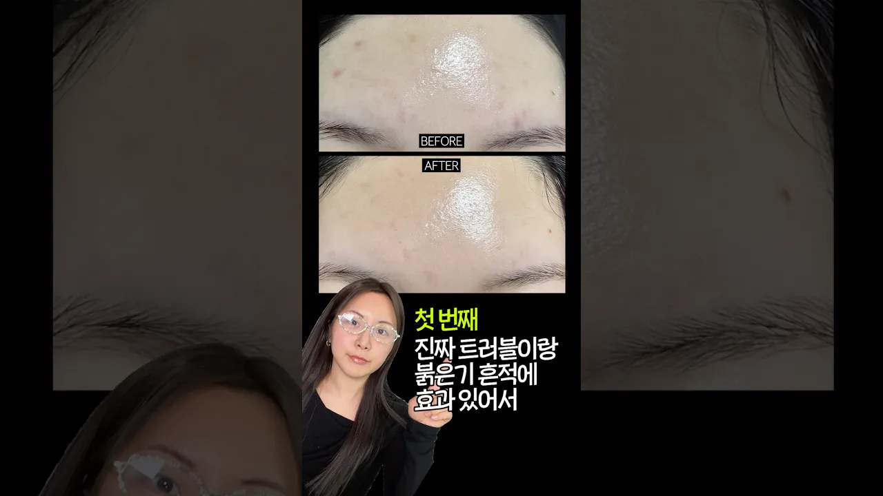 클레어스 블루드롭 쓰는 이유