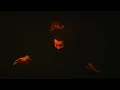 You Me At Six - Traumatic Iconic