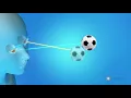 What is amblyopia lazy eye