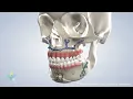 Jaw Surgery in Dallas TX