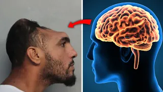 imethibitika unaweza kuishi bila viungo hivi mwilini bila shida yoyote 