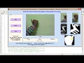Hand Gesture Recognition using matlab code