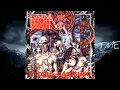 Download Lagu 02-I Abstain-Napalm Death-HQ.320k.