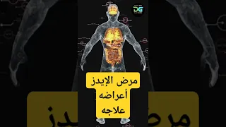 مرض الإيدز أعراضه علاجه        دندنها