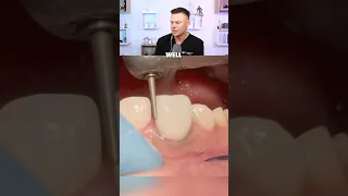 Dentist Reacts To The ART of Restorative Dentistry! 😮🦷