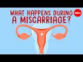 What happens in your body during a miscarriage - Nassim Assefi and Emily M Godfrey