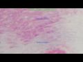 STRATUM CORNEUM