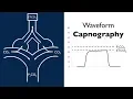 Waveform Capnography -