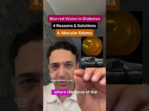 Blurred vision in diabetes 4 reasons & diabetes #diabetes #diabetesreversal #english #health #eyes
