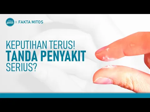Keputihan Terus? Kenali Ciri Keputihan Abnormal yang Berbahaya