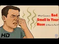 Is It Sinusitis or Something Else Uncovering the Cause of Nasal Odor
