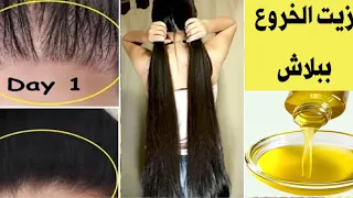 ببلاش أملي بيتك زيت الخروع لتطويل الشعر وانبات الفراغات وعلاج التساقط والتقصف والهيشان وفرد الشعر 