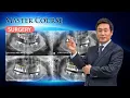 Download Lagu [Masteropleiding - CHIRURGIE] Verschillende botmaterialen voor SG