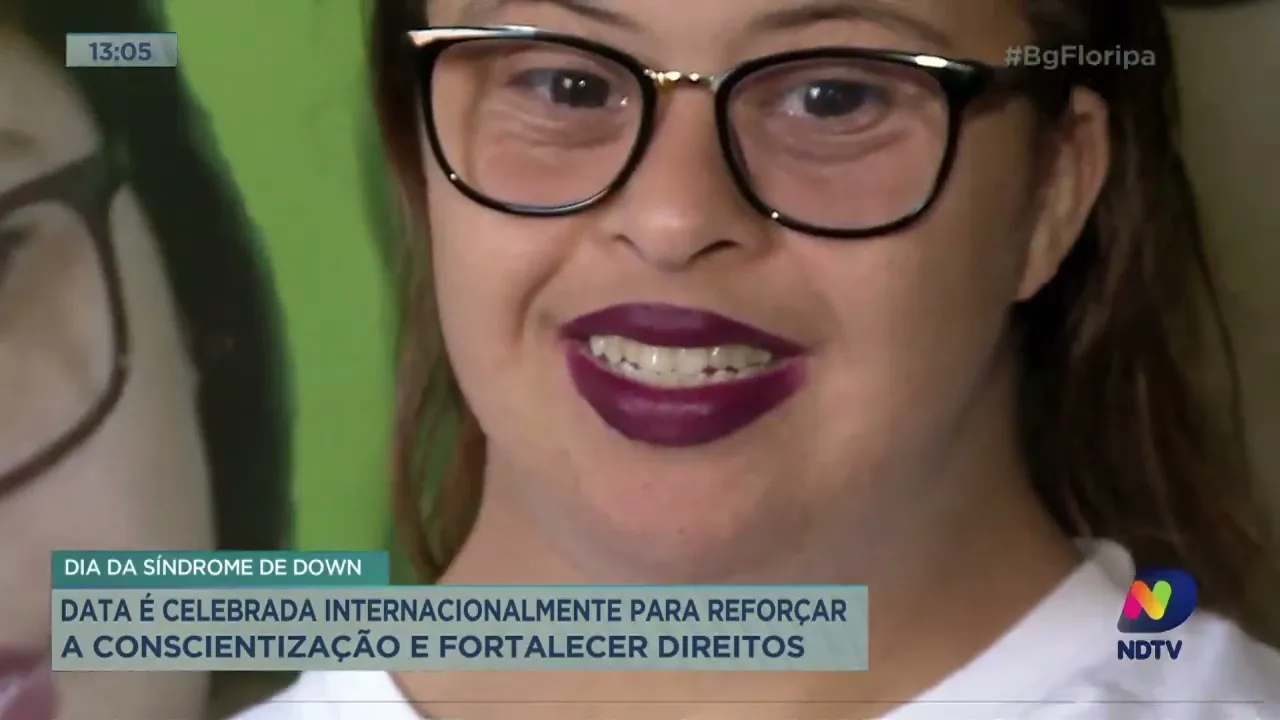 Dia da Síndrome de Down: data é celebrada internacionalmente para reforçar a conscientização