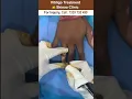 Download Lagu Vitiligo treatment at skinaa clinic #vitiligomodel #vitiligo #shorts #viralshorts  #skinaaclinic