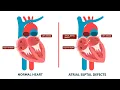Obliteration CPT code - simplify medical coding