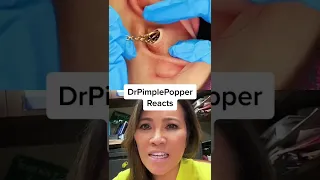 TOO SATISFYING TO BE REAL Dr Pimple Popper Reacts