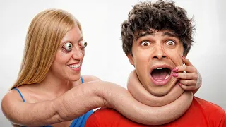 I Met 7 Rare People You WONT Believe Exist!