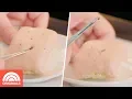 Dr Pimple Popper Teaches Us How To Remove A Blackhead Skin Care A-to-Z TODAY