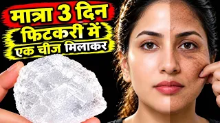 गारंटी है, 💯 1 ही बार में, झाइयां हटा के, बहुत गोरा कर देगी,10₹ की फिटकरी,# फिटकिरी, Alum for face