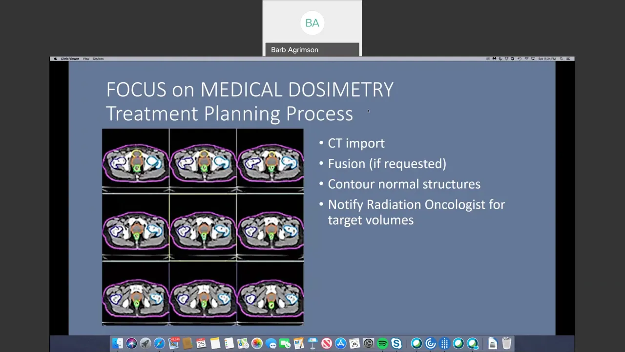 Dosimetry Lecture from a Dosimetrist