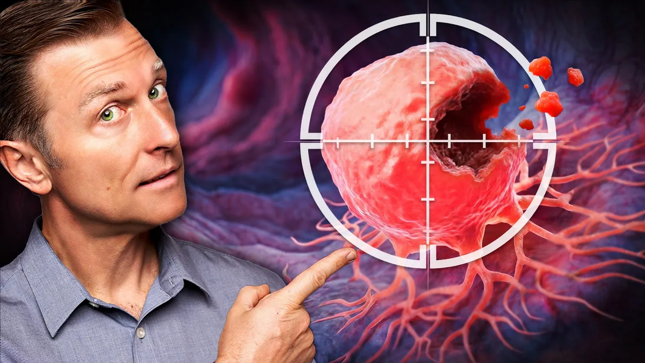 Advanced-Stage Colon Cancer Dies When You Do THIS