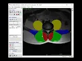 Opening and Saving Images in ITK SNAP