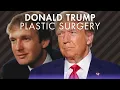 Donald Trump s Ex-Wife Revealed His Plastic Surgery Secret