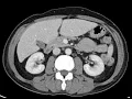 Anatomy of CT scans Abdomen