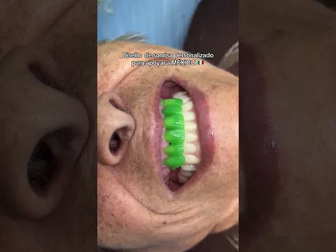 Venga México 🇲🇽 #dentista #odontologia #shorts