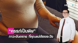 การรักษาคันเป็นพิษทำอย่างไรบ้าง