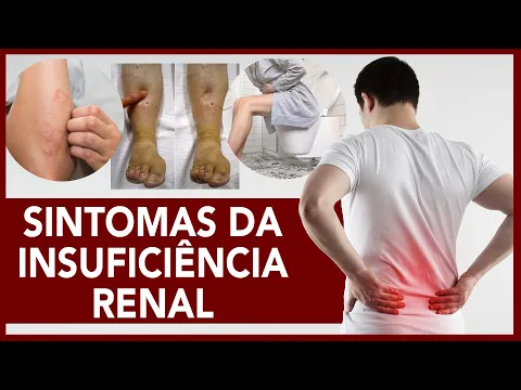 Download MP3 Sintomas da insuficiência renal